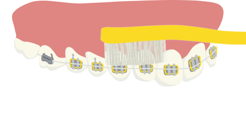 Brossage des dents, étape 1