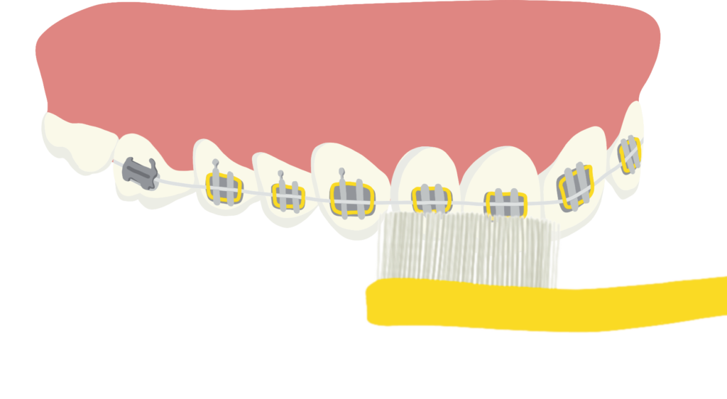 Brossage des dents, étape 3