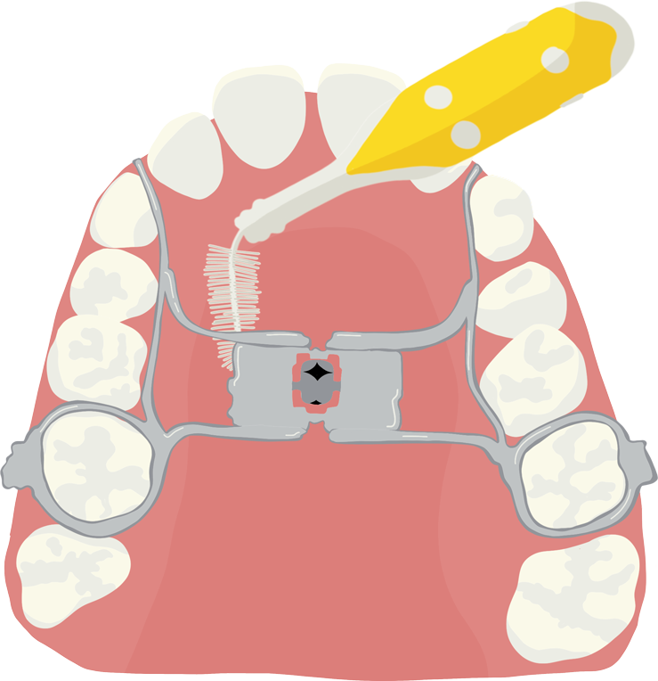 Brossage appareil disjoncteur avec la brossette