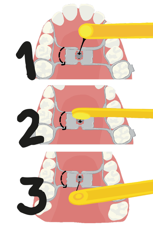 Illustration des étapes d'activation du disjoncteur grâce à la clef.